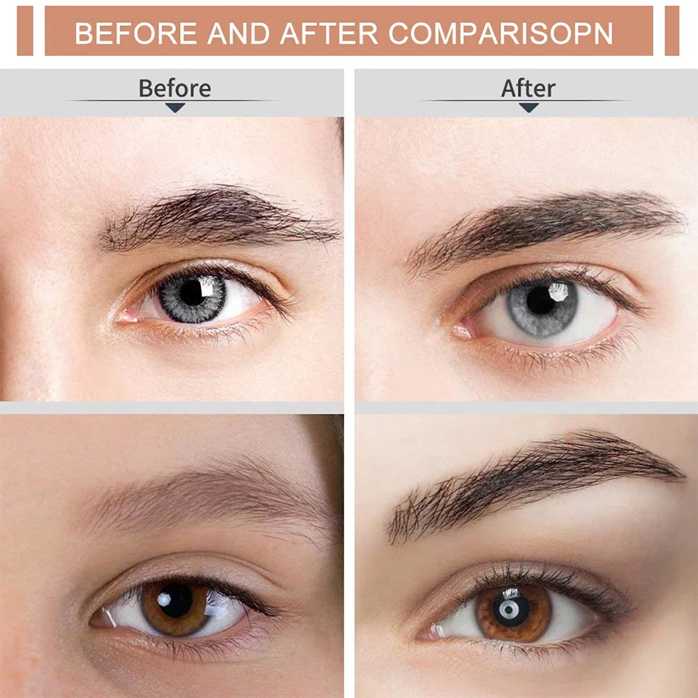 Women's Painless Facial Hair Remover with LED for Flawless Skin