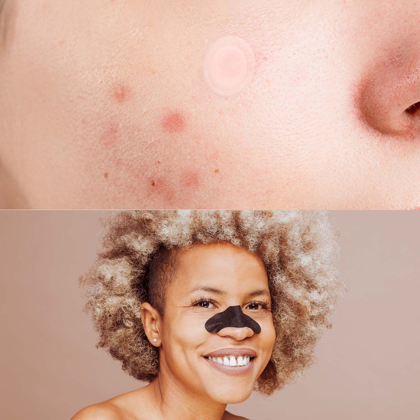 Pursonic Deep Cleansing Charcoal Nose Pore Strip & Hydrocolloid Set